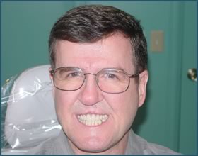 Happy Patients of Dr. Andrews & Smile Seattle Dentures