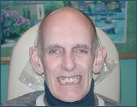 Happy Patients of Dr. Andrews & Smile Seattle Dentures