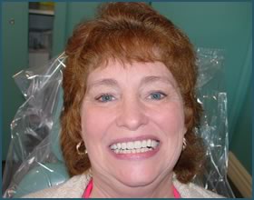 Happy Patients of Dr. Andrews & Smile Seattle Dentures