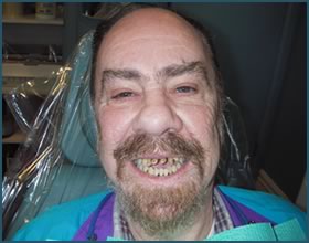 Happy Patients of Dr. Andrews & Smile Seattle Dentures